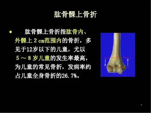 肱骨髁上骨折PPT演示课件