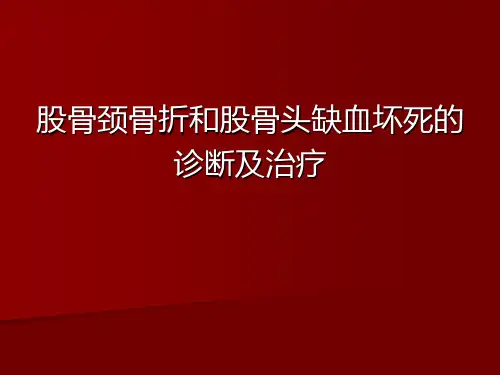 股骨颈骨折和股骨头缺血坏死的诊断及治疗