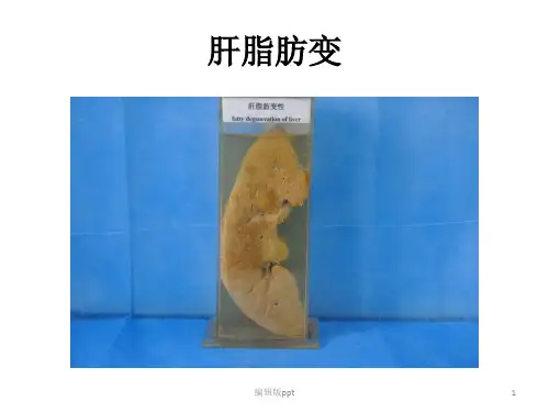 病理大体标本PPT课件