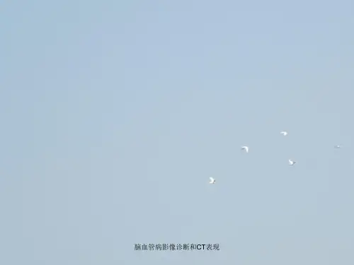 脑血管病影像诊断与CT表现