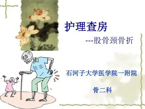 股骨颈骨折的理查房26576