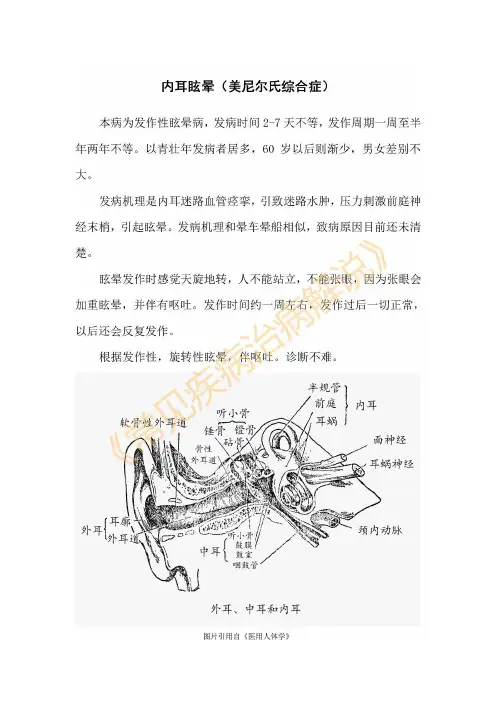 内耳眩晕、美尼尔氏综合症(常见疾病治病解说-作者上传)