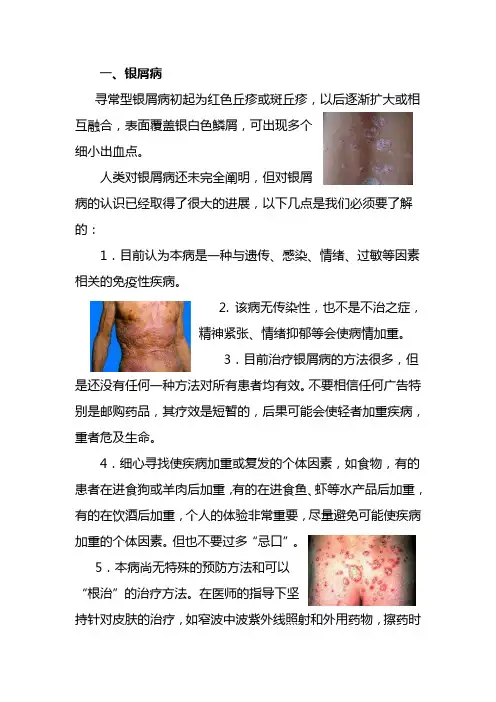 常见皮肤病