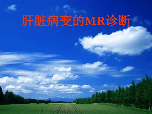 肝脏病变MR诊断