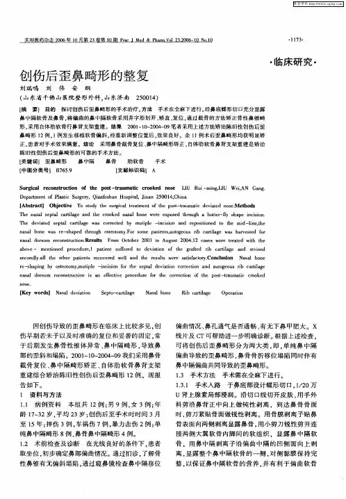 创伤后歪鼻畸形的整复