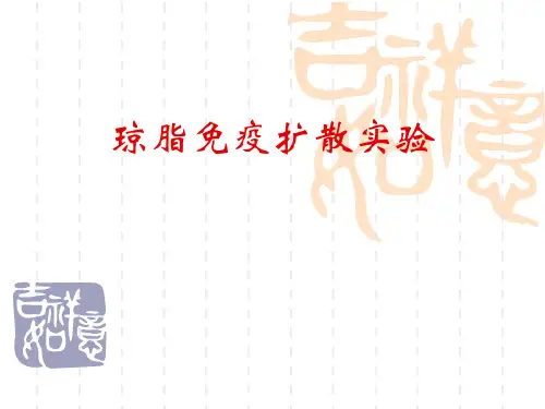 免疫学实验课件:实验三(2)琼脂免疫扩散实验