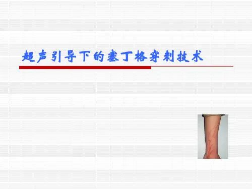 超声引导下的塞丁格穿刺技术_