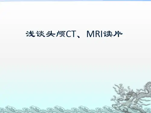 头颅CT及MRI读片知识