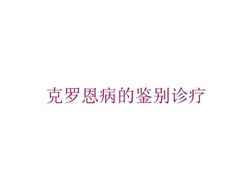 克罗恩病的鉴别诊疗培训课件
