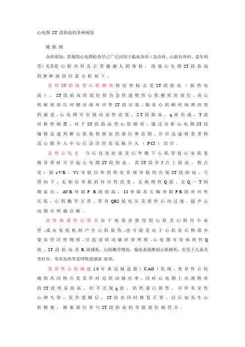 心电图ST段抬高的多种病因