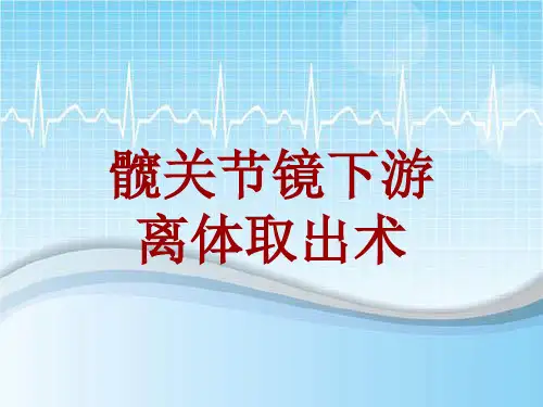 手术讲解模板:髋关节镜下游离体取出术