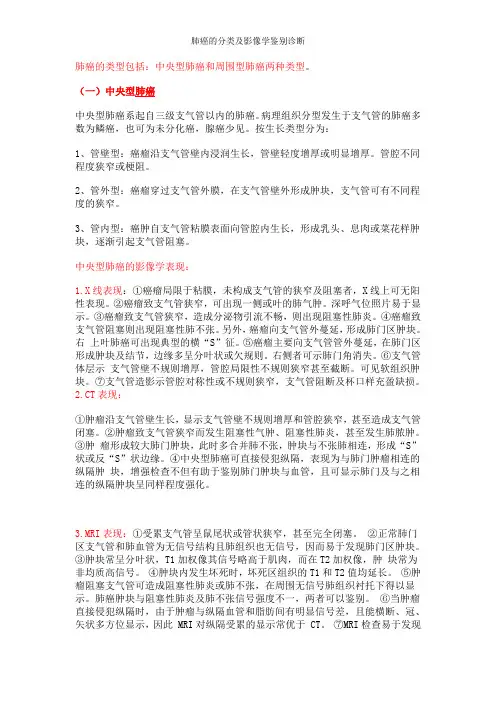 肺癌的分类及影像学鉴别诊断