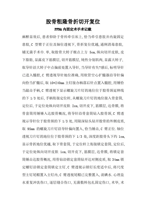 股骨粗隆骨折切开复位PFNA内固定术