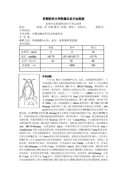 右椎动脉血管内支架成形术手术记录
