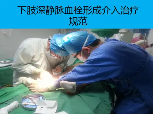 下肢深静脉血栓溶栓指南ppt课件