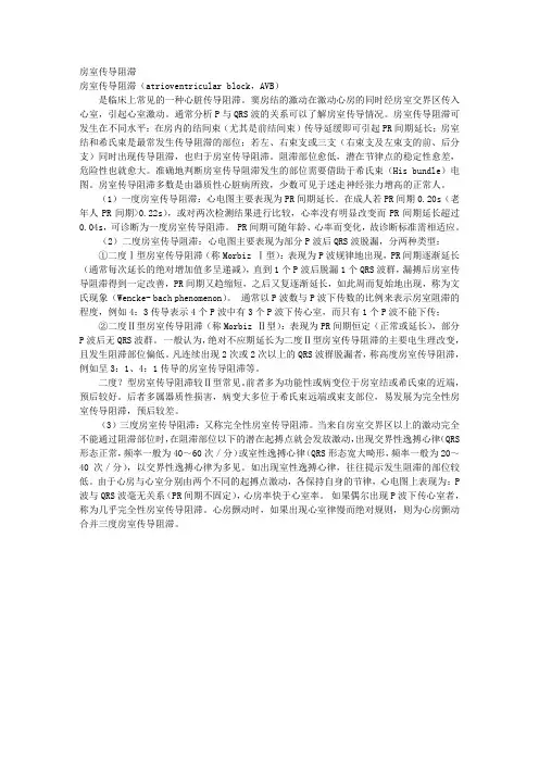 房室传导阻滞 