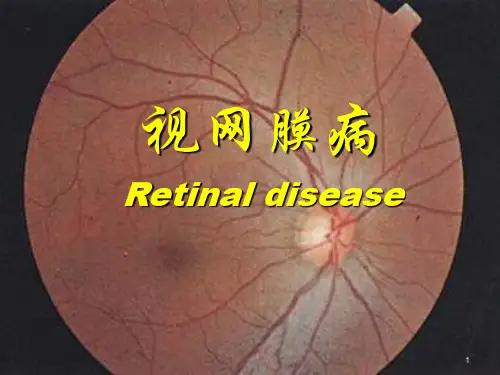 视网膜病图谱精品PPT课件