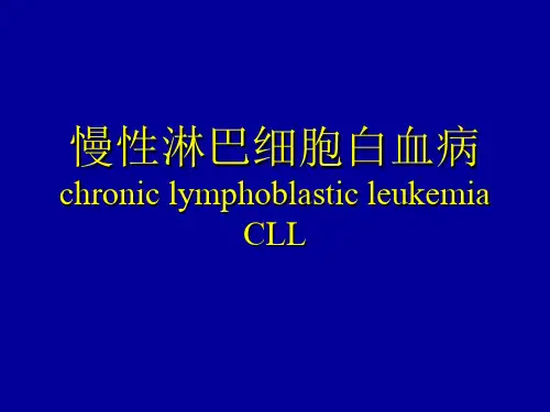 慢性淋巴细胞白血病CLL