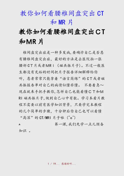 最新教你如何看腰椎间盘突出CT和MR片(精品收藏)