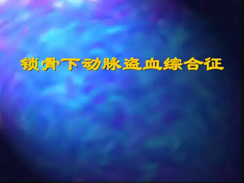 锁骨下动脉盗血诊断