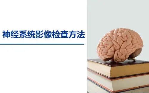 神经系统影像科检查方法