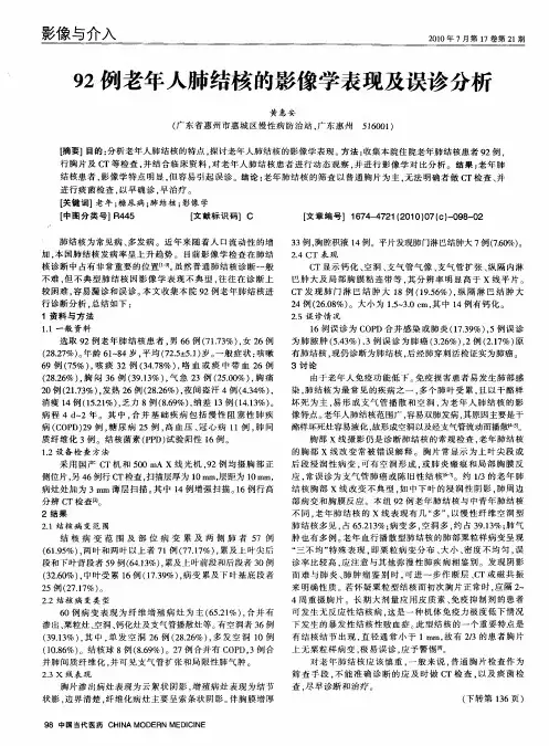 92例老年人肺结核的影像学表现及误诊分析