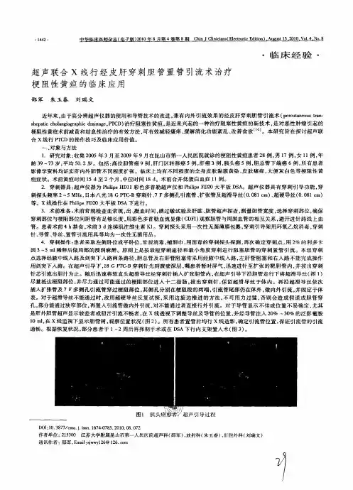 超声联合X线行经皮肝穿刺胆管置管引流术治疗梗阻性黄疸的临床应用