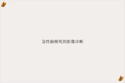 急性脑梗死的影像诊断课件