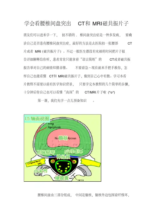 学会看腰椎间盘突出CT和MRI磁共振片子.pdf