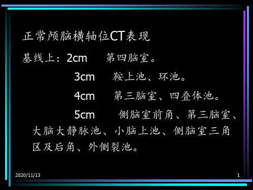 头颅CT解剖 ppt课件
