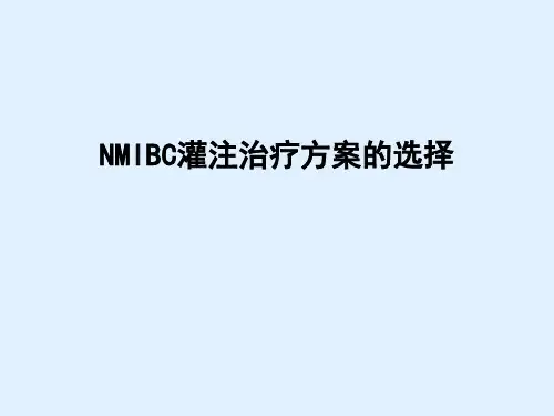 NMIBC灌注治疗方案的选择