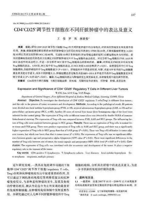 CD4 +CD25 +调节性T细胞在不同肝脏肿瘤中的表达及意义