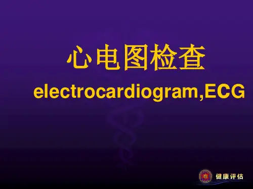 心电图基本知识