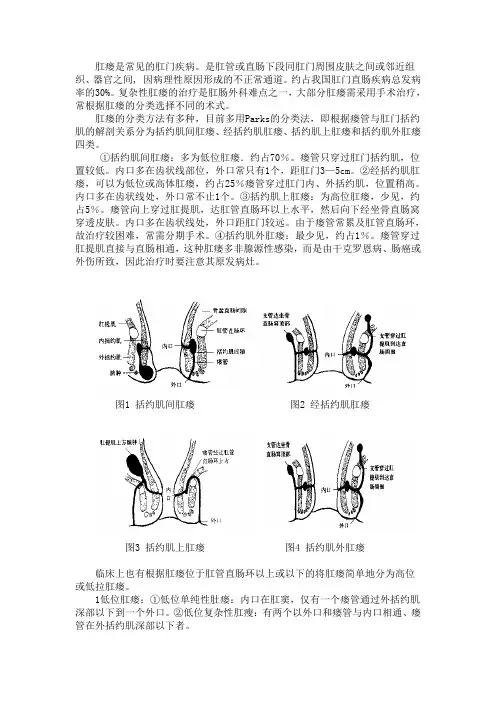 第四节 肛瘘