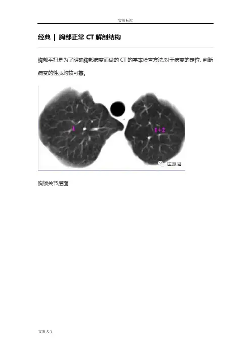 胸部正常CT解剖结构