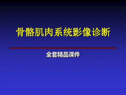 骨骼肌肉系统影像诊断全套课件