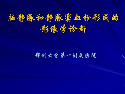 脑静脉和静脉窦血栓形成的影像学诊断(程敬亮)
