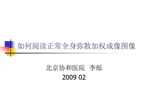 全身正常DWI表现