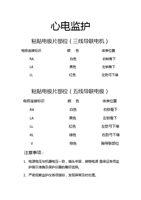 心电监护