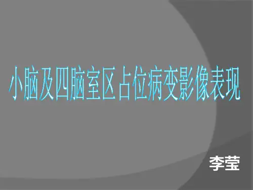 小脑及四脑室区占位病变