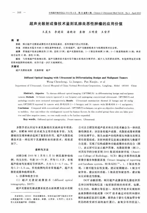 超声光散射成像技术鉴别乳腺良恶性肿瘤的应用价值