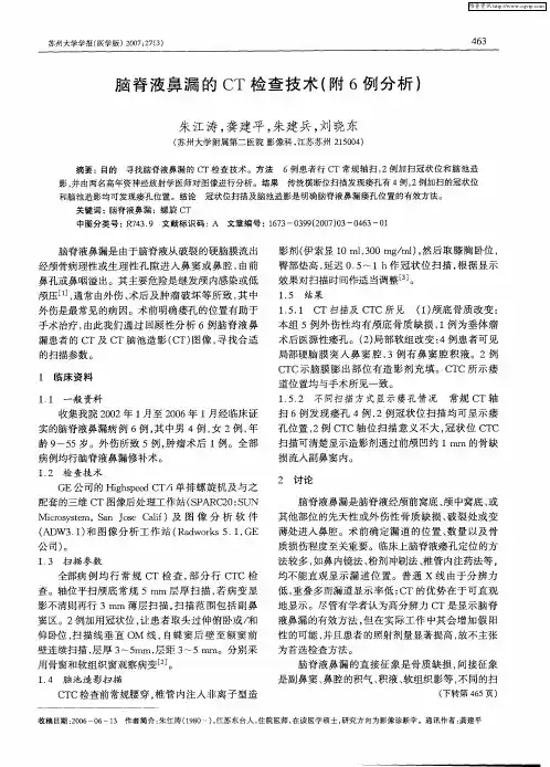 脑脊液鼻漏的CT检查技术(附6例分析)
