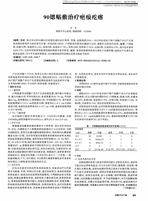 90锶贴敷治疗疤痕疙瘩