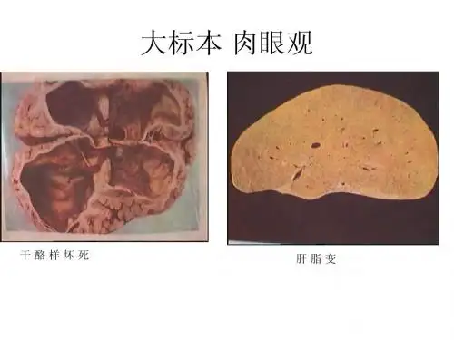 第一,二章 损伤
