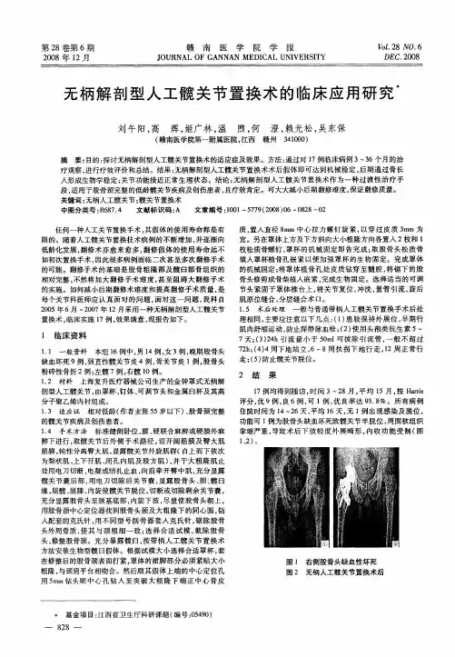无柄解剖型人工髋关节置换术的临床应用研究