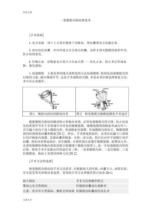 一般腹股沟斜疝修复术手术图谱