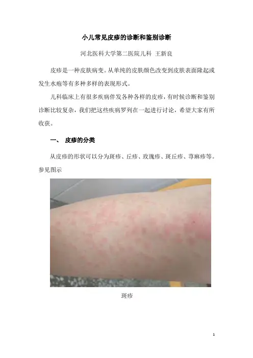 小儿常见皮疹的诊断和鉴别诊断
