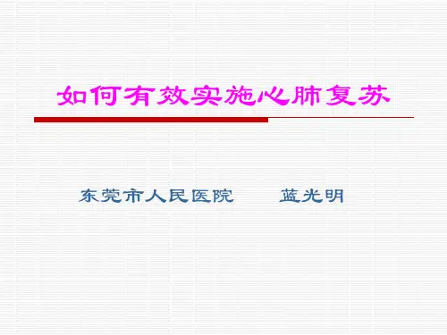 心肺复苏