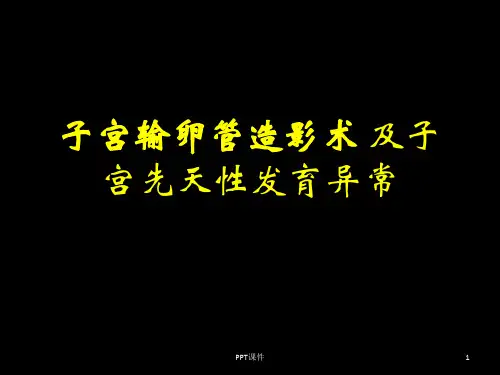 子宫输卵管造影及先天性发育异常 ppt课件