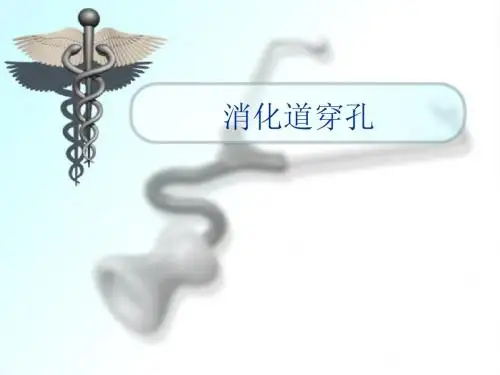 消化道穿孔